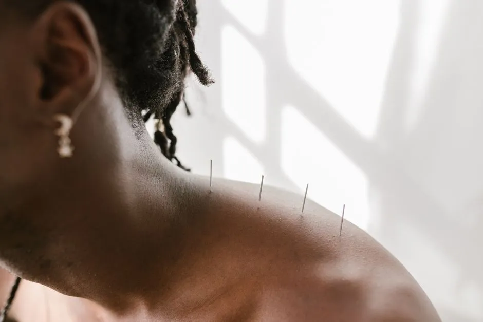 Online Booking & SMS Reminders for Acupuncture Clinics